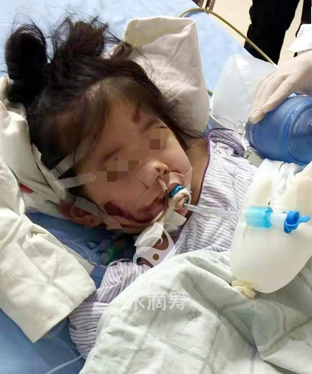 小区内车祸 小孩进ICU不幸去世小区内车祸，小孩进ICU不幸去世